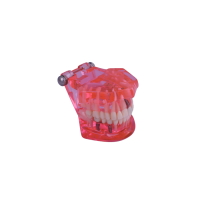 3D Dental Educational Restoration Model W/Implant 